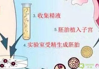 多次胎停建议试管婴儿吗（多次胎停建议试管婴儿吗有影响吗）